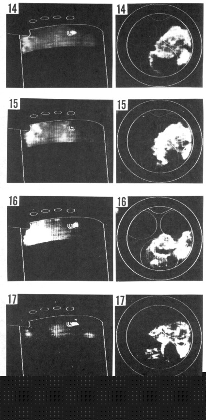 Figure 19b